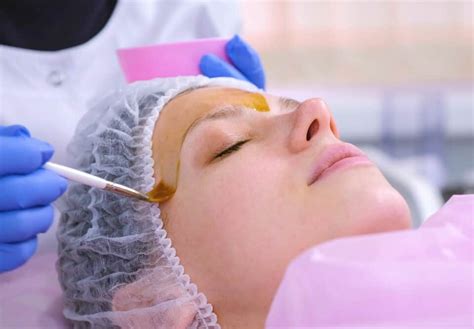 Chemical Peel — St Louis Dermatology Center.